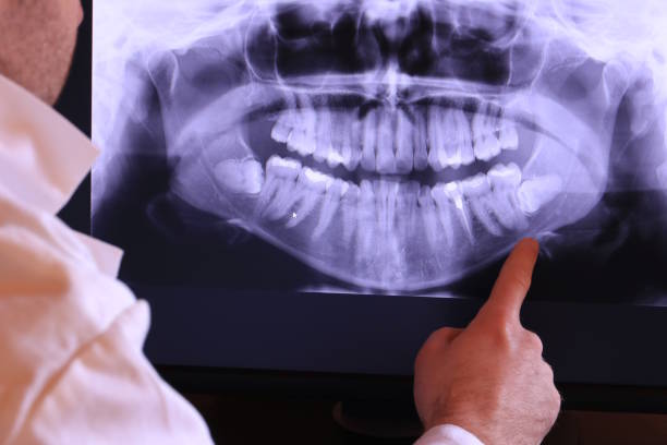 Best Emergency Treatment for Dental Infections or Abscesses in Marissa, IL